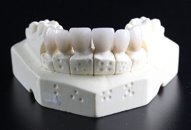 השתלות שיניים בבאר שבע